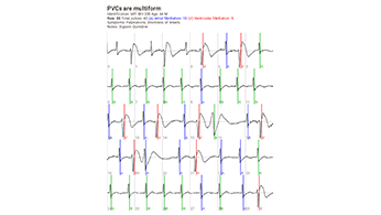 Compartir imagen de ECG Compartir imagen de ECG