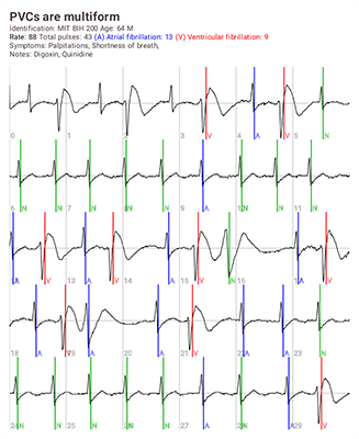 Compartir imagen de ECG
