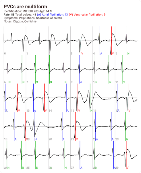 Compartir imagen de ECG