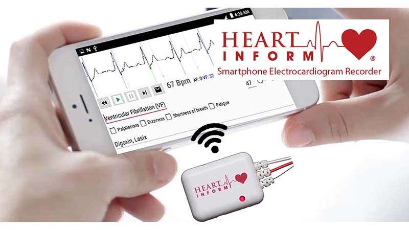 Heart Inform ECG Heart Inform ECG
